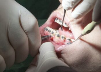 Centros de saúde do distrito sem um único dentista