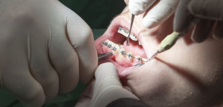 Centros de saúde do distrito sem um único dentista