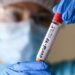 Em menos de uma semana, voluntários de Leiria esgotaram vagas no estudo serológico sobre a Covid-19