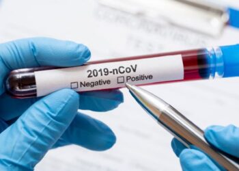 Batalha disponibiliza testes à Covid-19  para professores  e funcionários de escolas