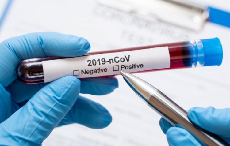 Batalha disponibiliza testes à Covid-19 para professores e funcionários de escolas