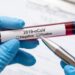 Batalha disponibiliza testes à Covid-19  para professores  e funcionários de escolas