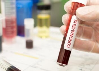 Covid-19: Distrito com 121 novos casos e mais três mortes