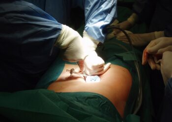 Sobrevivência do cancro do pâncreas é das mais baixas