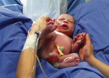Médicos obstetras não fazem cesarianas a pedido