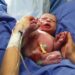 Médicos obstetras não fazem cesarianas a pedido