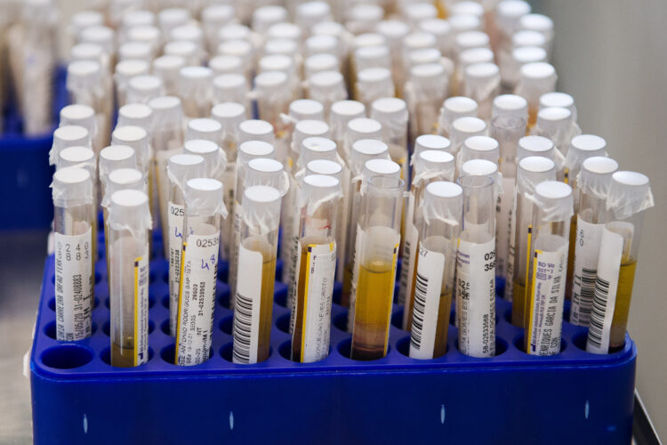 Covid-19: Caldas da Rainha e Pombal registam três novas infecções