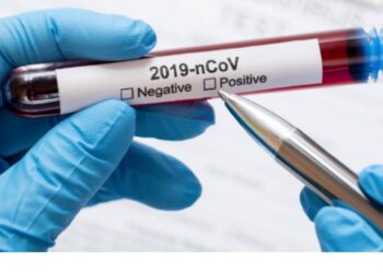 Covid-19: Ourém disponibiliza nova campanha de testagem à população
