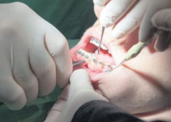 Mais de metade dos concelhos ainda sem dentista nos centros de saúde