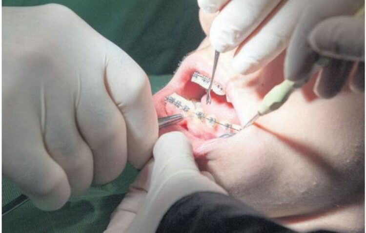 Mais de metade dos concelhos ainda sem dentista nos centros de saúde