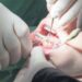Mais de metade dos concelhos ainda sem dentista nos centros de saúde