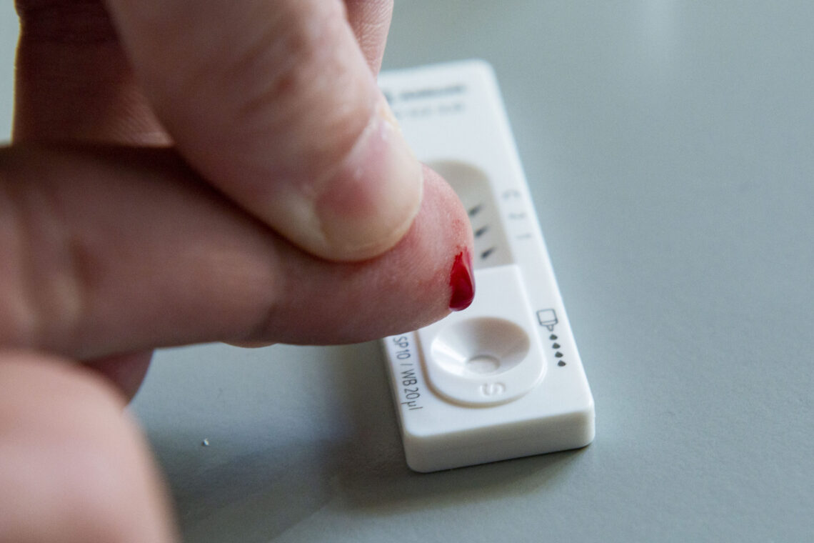 Infecções por VIH diminuem, mas é preciso insistir nos rastreios precoces