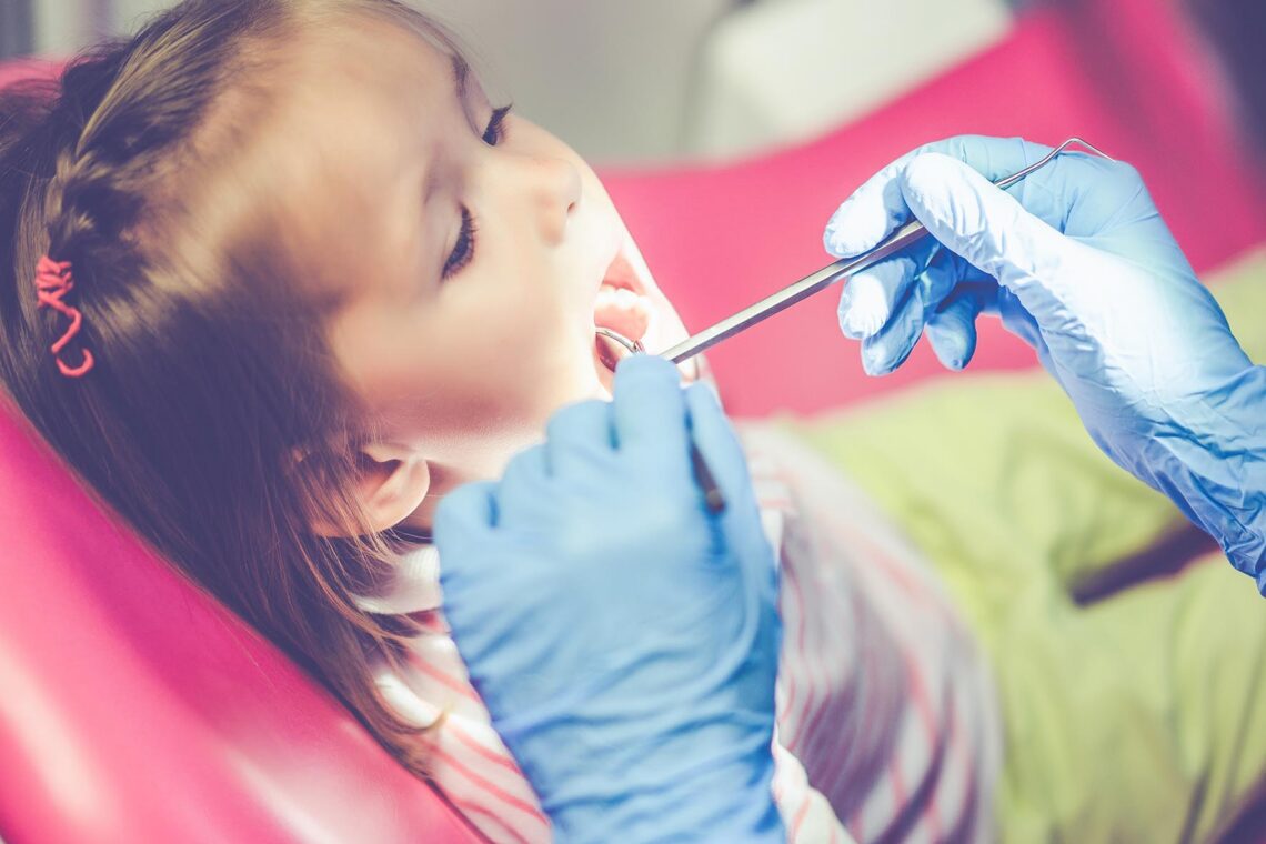 Dentistas declaram guerra ao açúcar por causar cáries nas crianças 