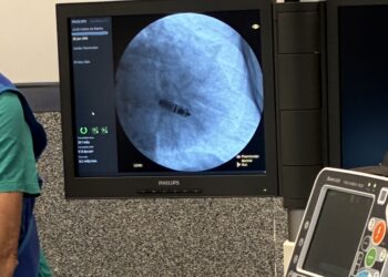 Hospital de Caldas da Rainha inicia prática de implantação de pacemakers