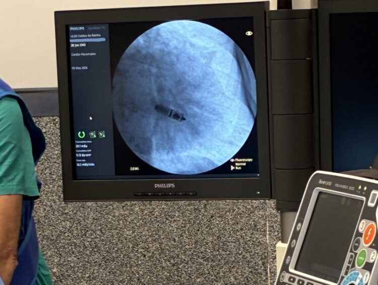 Hospital de Caldas da Rainha inicia prática de implantação de pacemakers