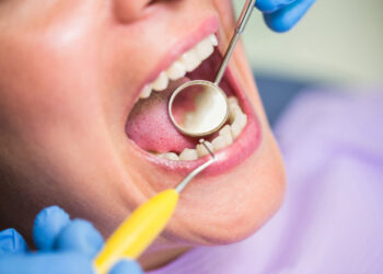 Projecto custeará tratamento de cáries, "em complemento" ao cheque-dentista